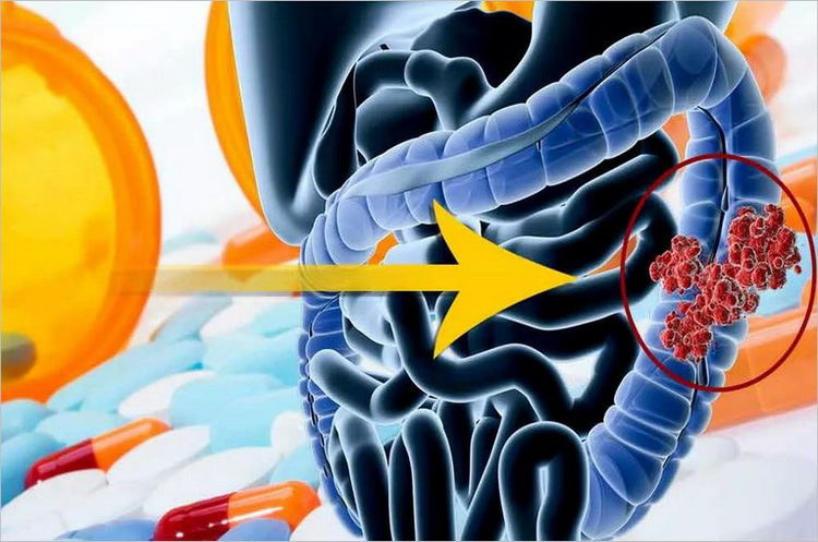 Стал известен популярный продукт, препятствующий раку кишечника у мужчин. смотреть онлайн