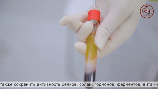 PRP  терапия- швейцарский лифтинг Regenlab