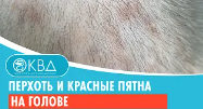 ? Перхоть и красные пятна на голове. Клинический случай №799
