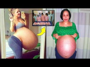 Эти Необычные Случаи Беременности Поразили Всех