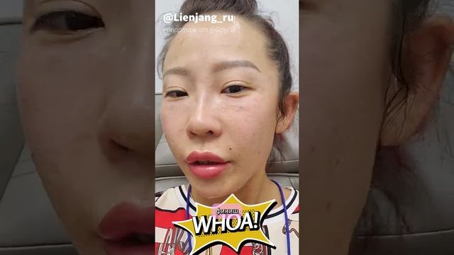 2022 10 01 Lienjang - -К-Бьюти в Клинике Лиенджанг, филлеры на 5 зон лица, Ботокс и Ин-Моуд смотреть онлайн