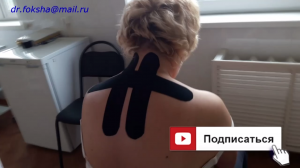 ШЕЙНЫЙ ОСТЕОХОНДРОЗ Тейпирование