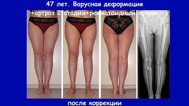 Д р Артемьев1 смотреть онлайн