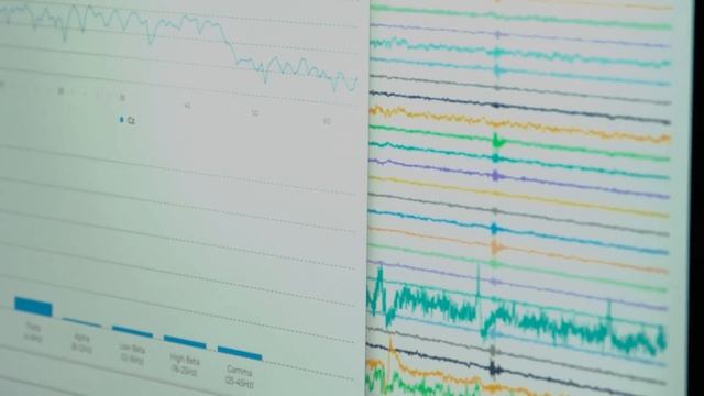Scanning The Brain Of The Ultimate Formula 1 Night Driver, Checo Perez. смотреть онлайн