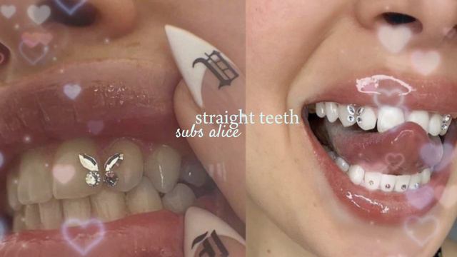 ⋆ ˚｡⋆୨୧˚у тебя очень красивые и ровны зубы//саблиминал//　˚୨୧⋆｡˚ ⋆