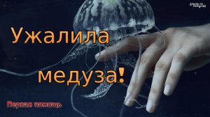 Что делать, если ужалила медуза. Первая помощь.