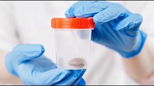 АНАЛИЗ КАЛА НА СКРЫТУЮ КРОВЬ | Как правильно подготовиться к исследованию