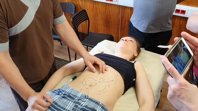 как найти двенадцатиперстную кишку и привратник на практике