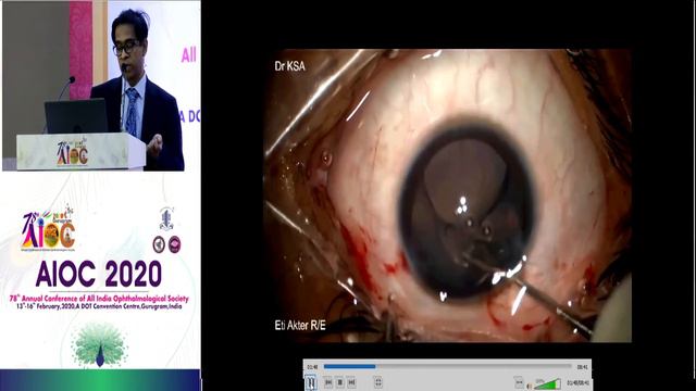 AIOC2020 IC420 T3 Dr KAZI SHABBIR ANWAR "Keynote Address by IOL Implantation in Difficult Paedi смотреть онлайн