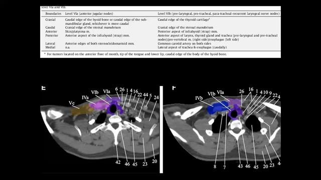 imaging of cervical lymph nodes , new leveling смотреть онлайн