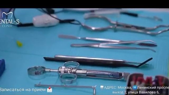 #стоматология#отзывы#мигрант#москва#лучшее#рекомендации#новыйгод#зубы#красивыезубы#красивые#доктор смотреть онлайн