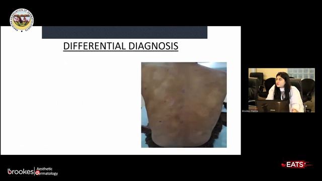 Dermatology Clinicopathological Conference - Grey Cases смотреть онлайн