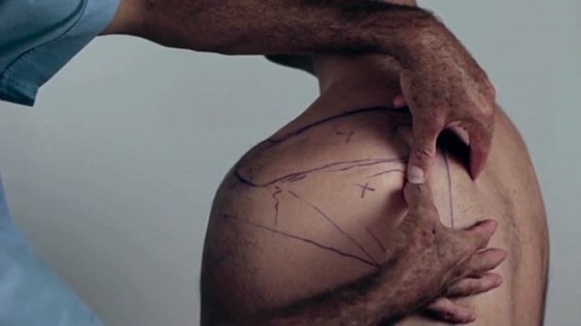 Trigger Point Master Class - How To Release Infraspinatus