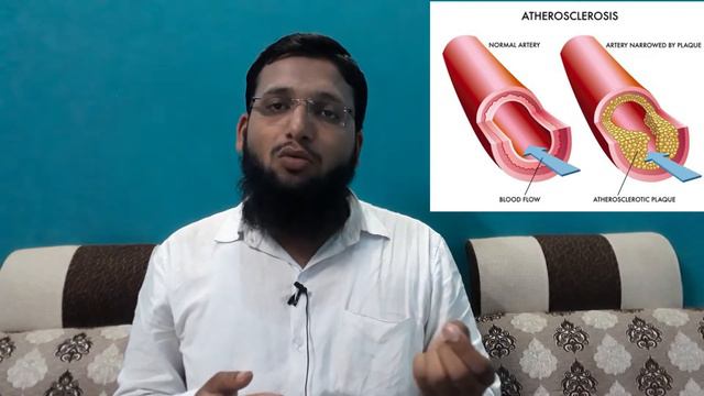 What Is Cholesterol ? Is It Good Or Bad For Human Body ? Homeopathic Medicine For High Cholesterol