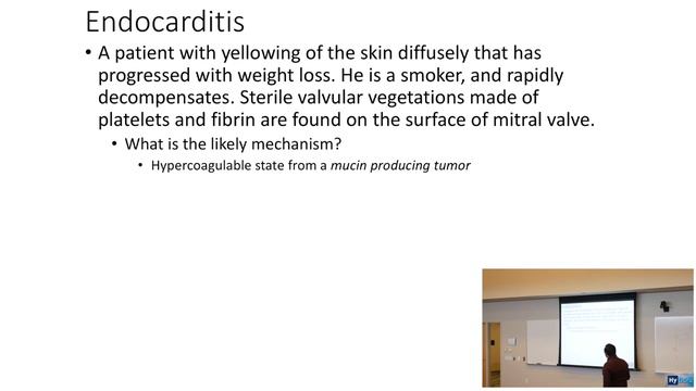 HyGuru USMLE Step 1: Cardiology | Endocarditis, Myocarditis, & Pericarditis смотреть онлайн
