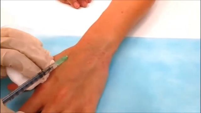 Биоревитализация кистей рук. Клиника "ВиАнта" смотреть онлайн