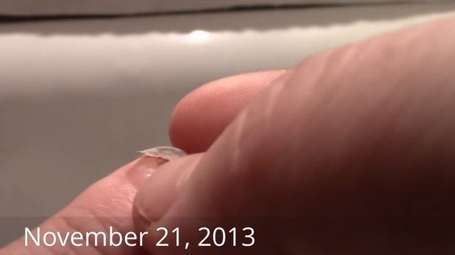 Evolution of a Smashed Fingernail смотреть онлайн