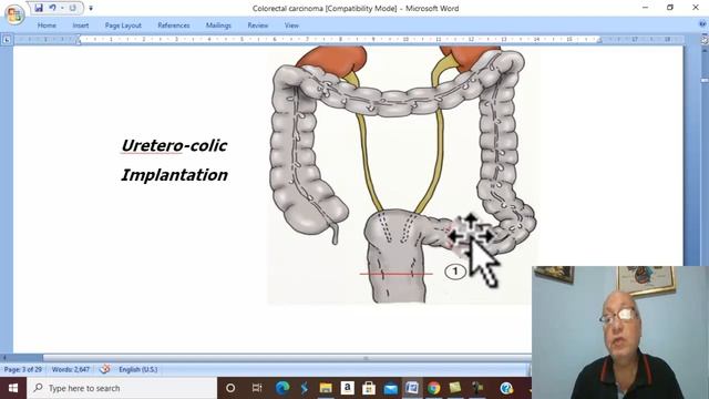 GIT Tumors in Arabic 12 ( Colo-rectal Carcinoma , part 1) , by Dr. Wahdan смотреть онлайн