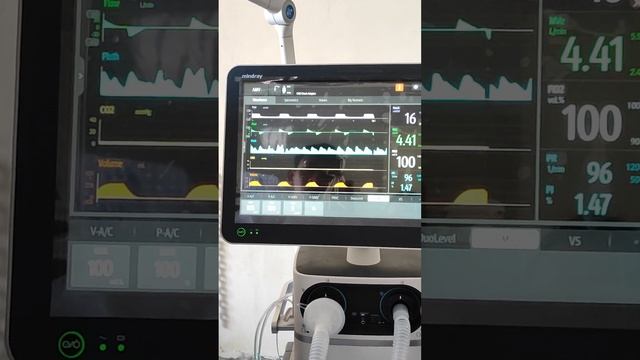 Uji fungsi Ventilator merek Mindray SV800 смотреть онлайн