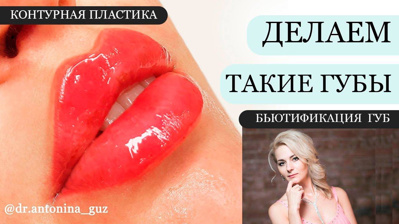 Как сделать ТАКИЕ ГУБЫ?!? Контурная пластика / увеличение губ филлером / бьютификация губ - обучение смотреть онлайн