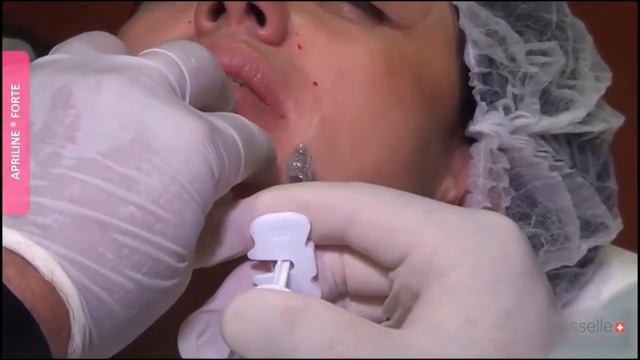 APRILINE® Forte ( мастер-класс) смотреть онлайн