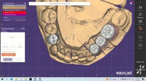 EXOCAD: БЕСПЛАТНЫЙ КУРС | УРОК 4: ФУНКЦИЯ "КОПИРОВАНИЕ"