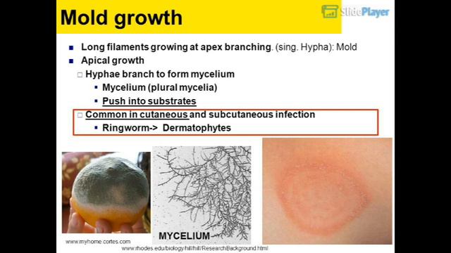 MORGELLONS in my UNDERWEARS! смотреть онлайн