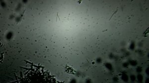 Бактерии зубного налета под микроскопом.