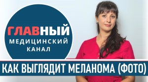 Как выглядит МЕЛАНОМА (фото 1-9). Симптомы и признаки меланомы. Как определить рак кожи