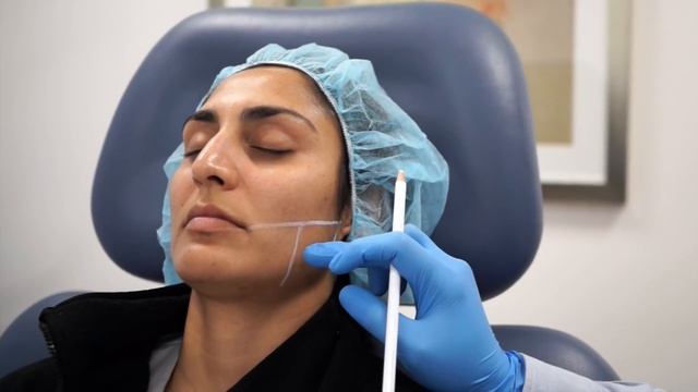 Botox Injection for Face Shaping, Jawline Reduction, and Masseter Hypertrophy (786) 618-5039 смотреть онлайн