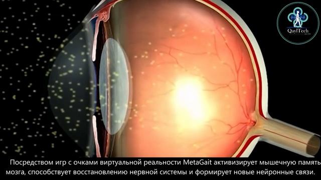 MetaGait: Инновационное решение для восстановления подвижности смотреть онлайн