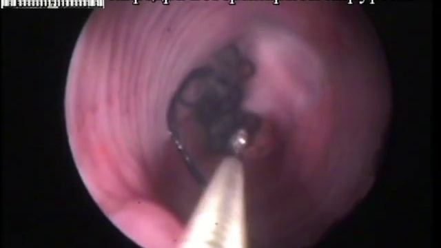 иголка в пищеводе у кота.mp4 смотреть онлайн