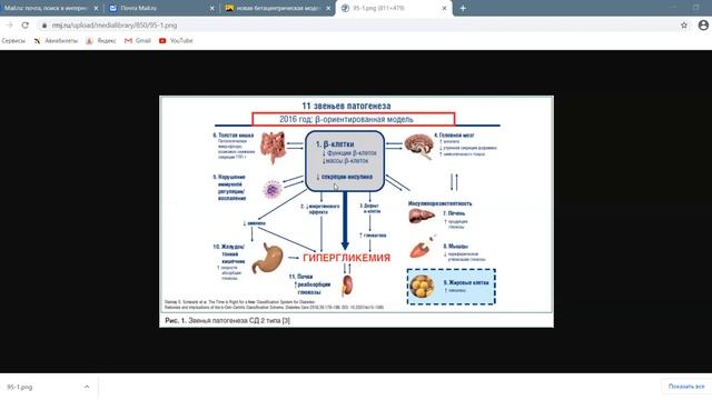 Этиология патогенез СД 2 типа смотреть онлайн