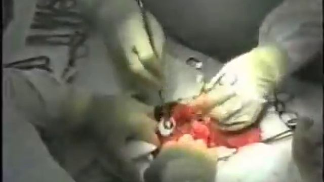 Хирургические инструменты.mp4 смотреть онлайн