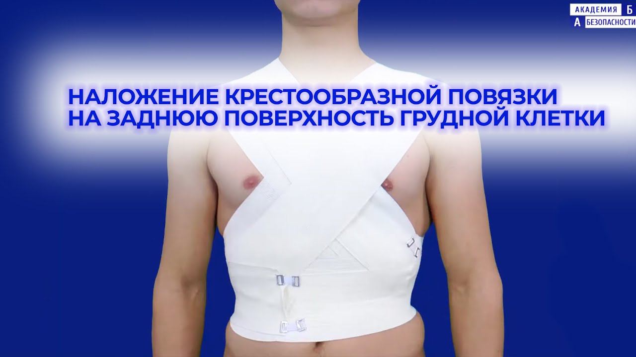Наложение крестообразной повязки на заднюю поверхность грудной клетки смотреть онлайн