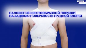 Наложение крестообразной повязки на заднюю поверхность грудной клетки