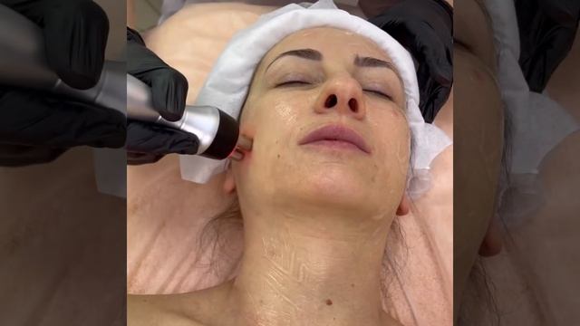 Rf лифтинг смотреть онлайн