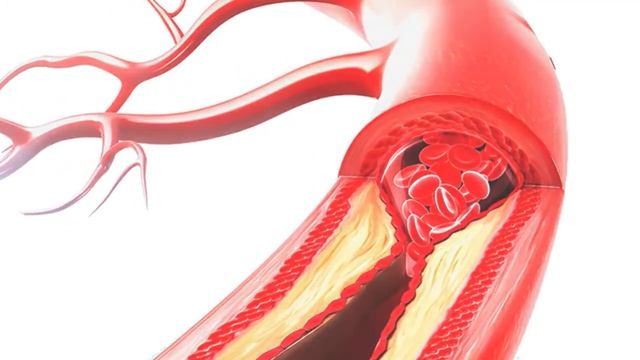 Чай продлевающий жизнь - Life extension tea смотреть онлайн