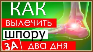 КАК ВЫЛЕЧИТЬ ПЯТОЧНУЮ ШПОРУ