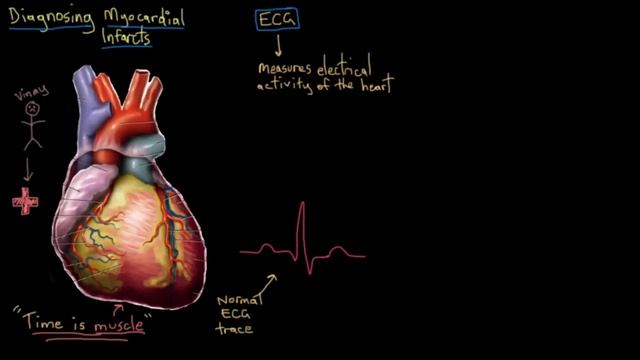 Heart attack (myocardial infarct) diagnosis | NCLEX-RN | Khan Academy смотреть онлайн