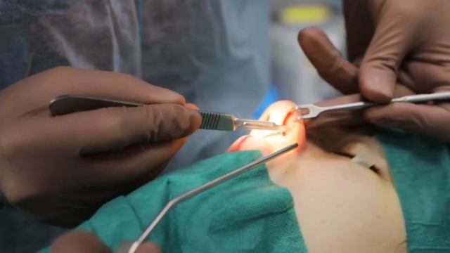 Агаев Ш.А. Ринопластика смотреть онлайн