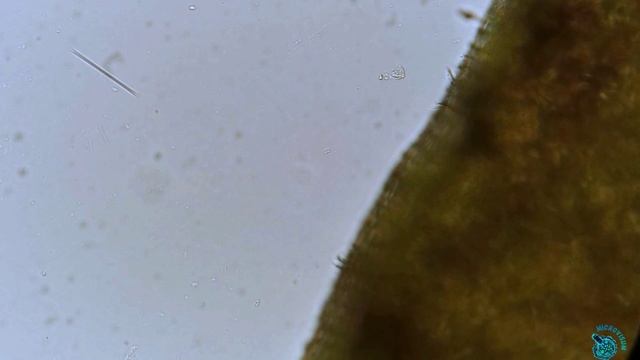 Сувойки (Vorticella) смотреть онлайн