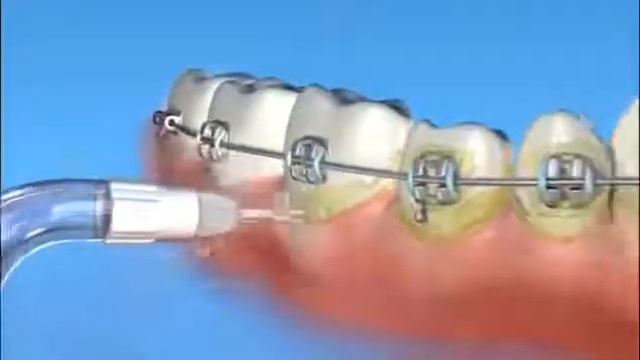 Ортодонтическая насадка GoFlow.com.ru смотреть онлайн