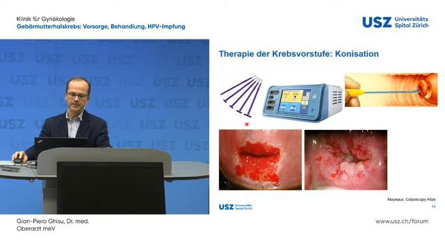 Forum (Livestream) – Gynäkologische Krebserkrankungen der Frau смотреть онлайн