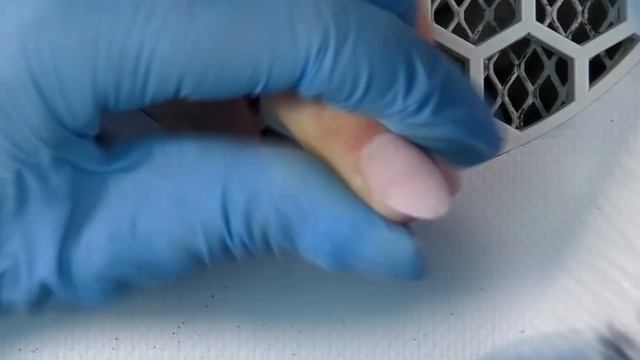 Годовалый онихолизис наконец срастает. Злой мастер маникюра