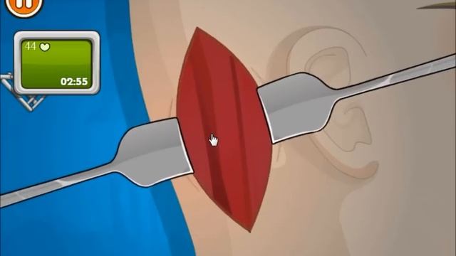 Operate Now: Eardrum Surgery - Walkthrough