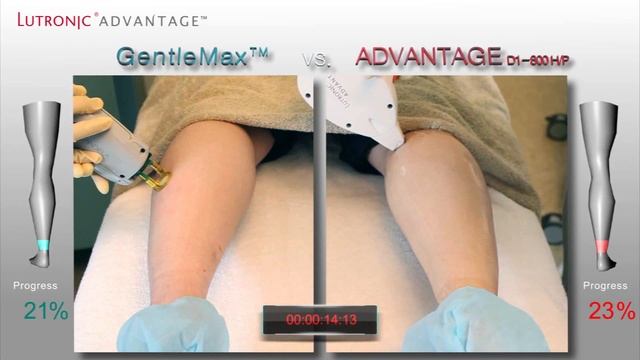 Аппарат Advantage, лазерная эпиляция
