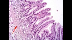 Пищеварительная система. Гистологические препараты
