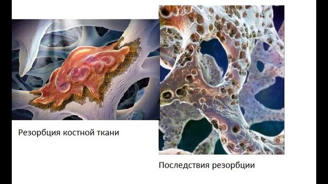 Костная ткань  Гистология