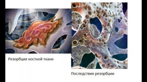 Костная ткань  Гистология